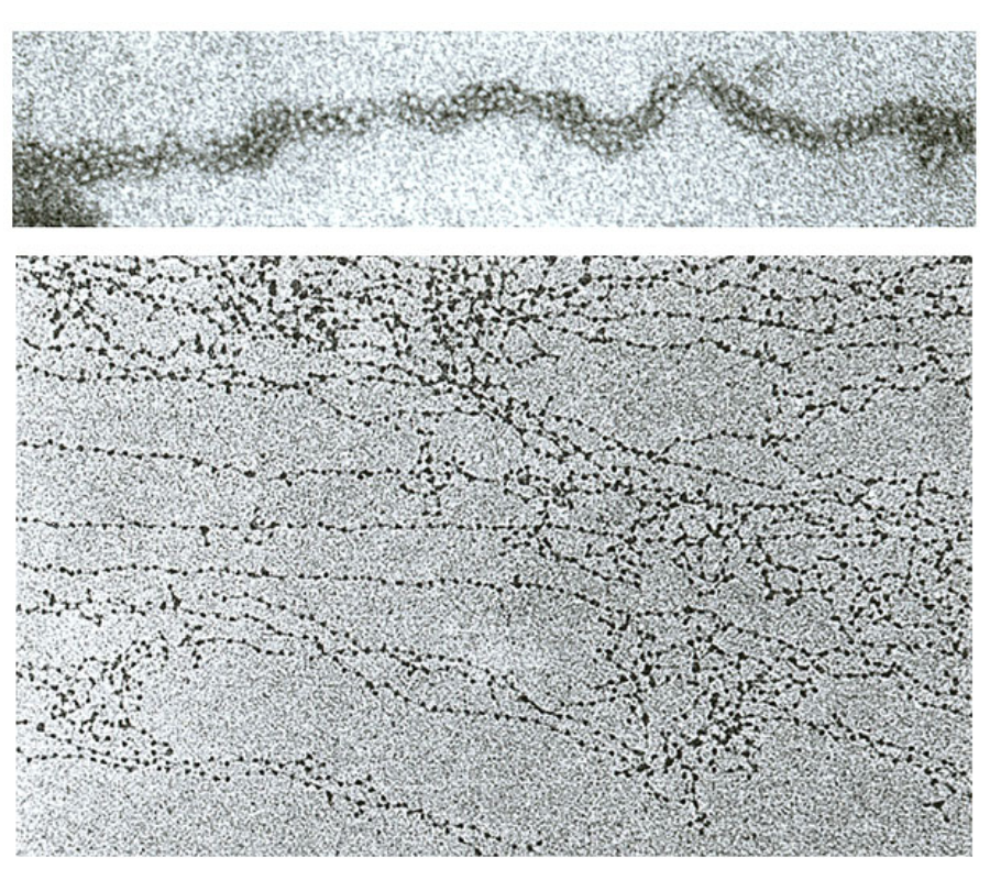 Electron micrographs of DNA wrapped around histones to form chromatin.