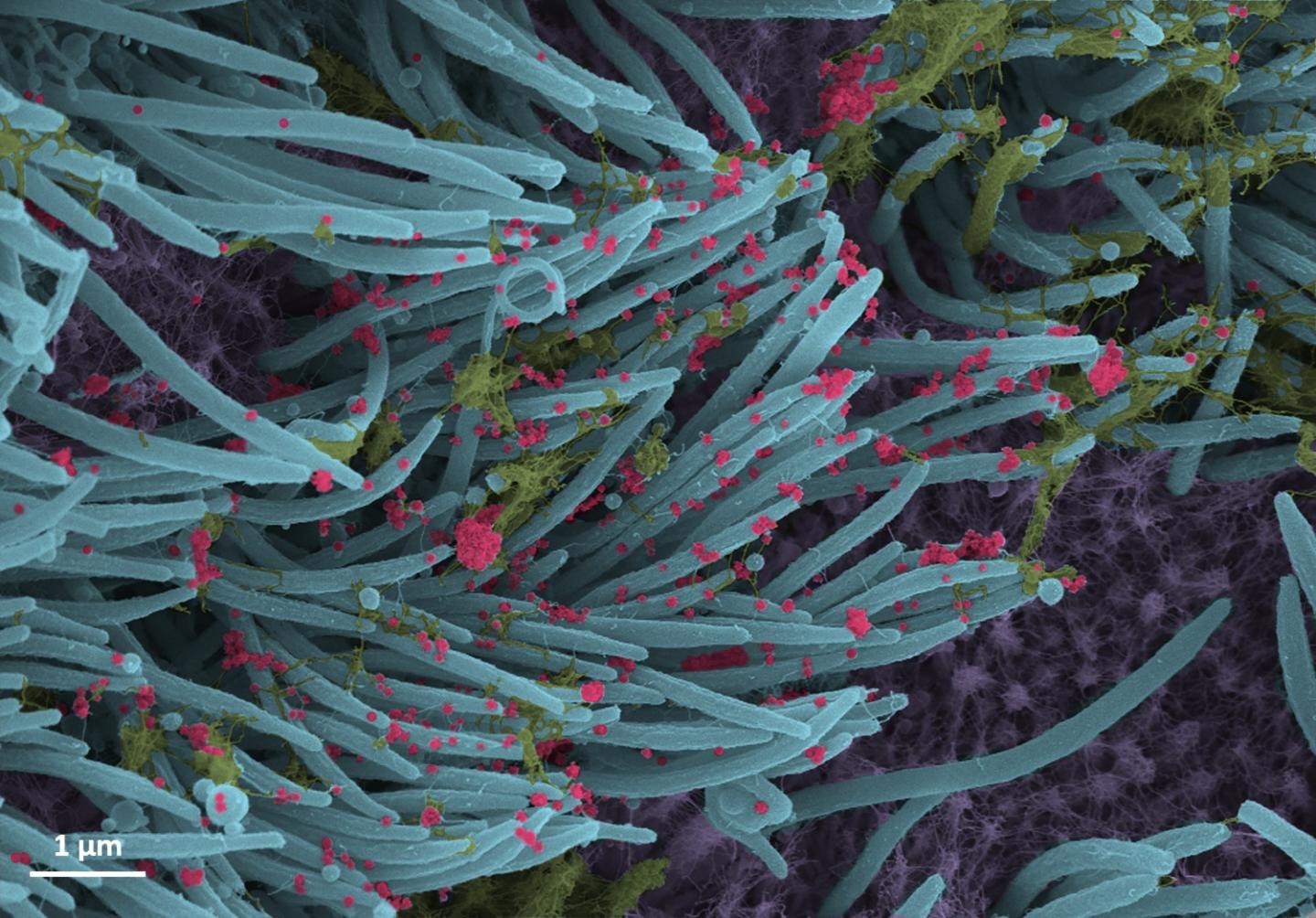 SARS-CoV-2 virus particles, colored red, produced by human airway epithelial cells.