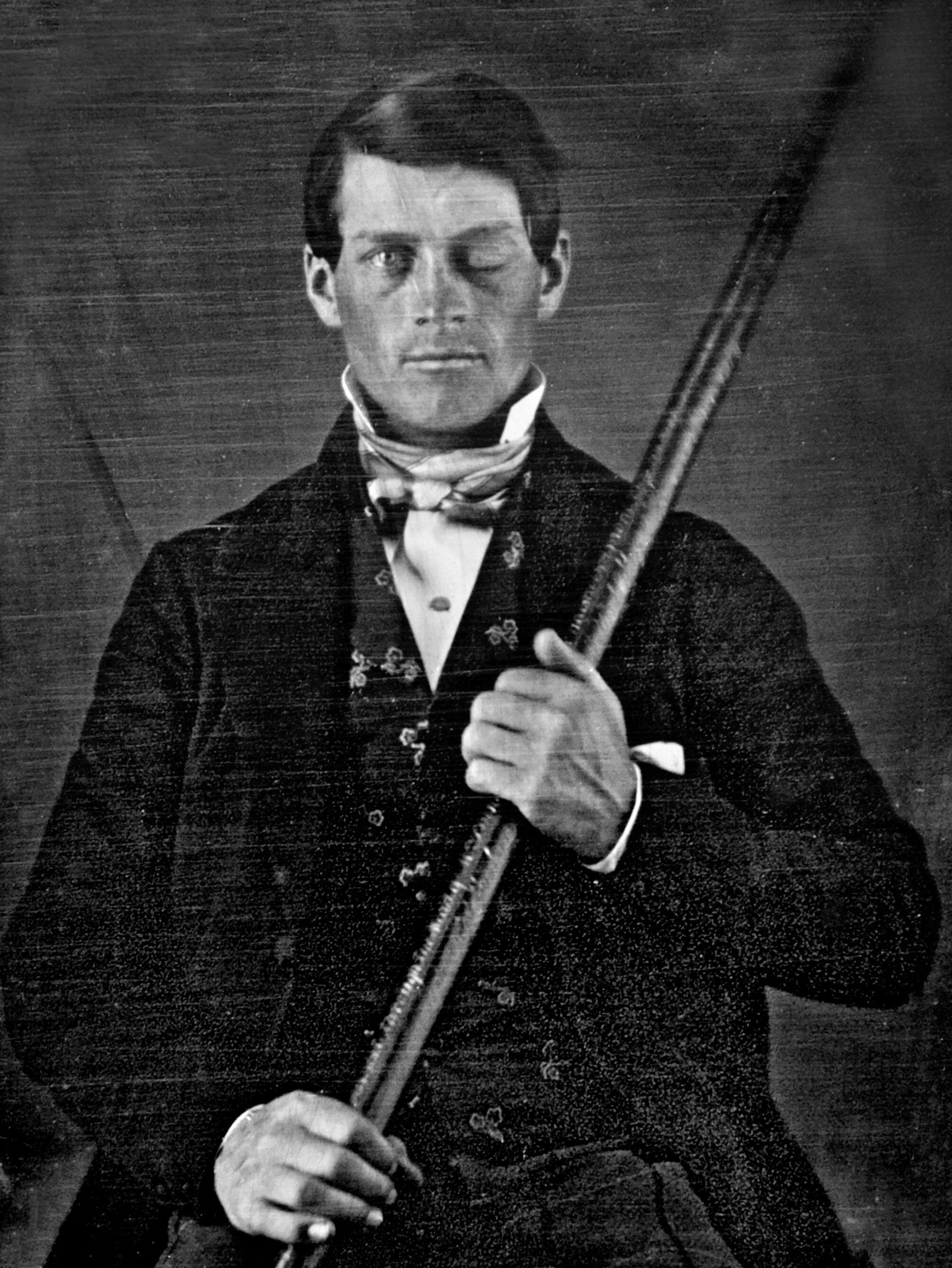 Daguerreotype of brain-injury survivor Phineas P. Gage holding the tamping iron which injured him.
