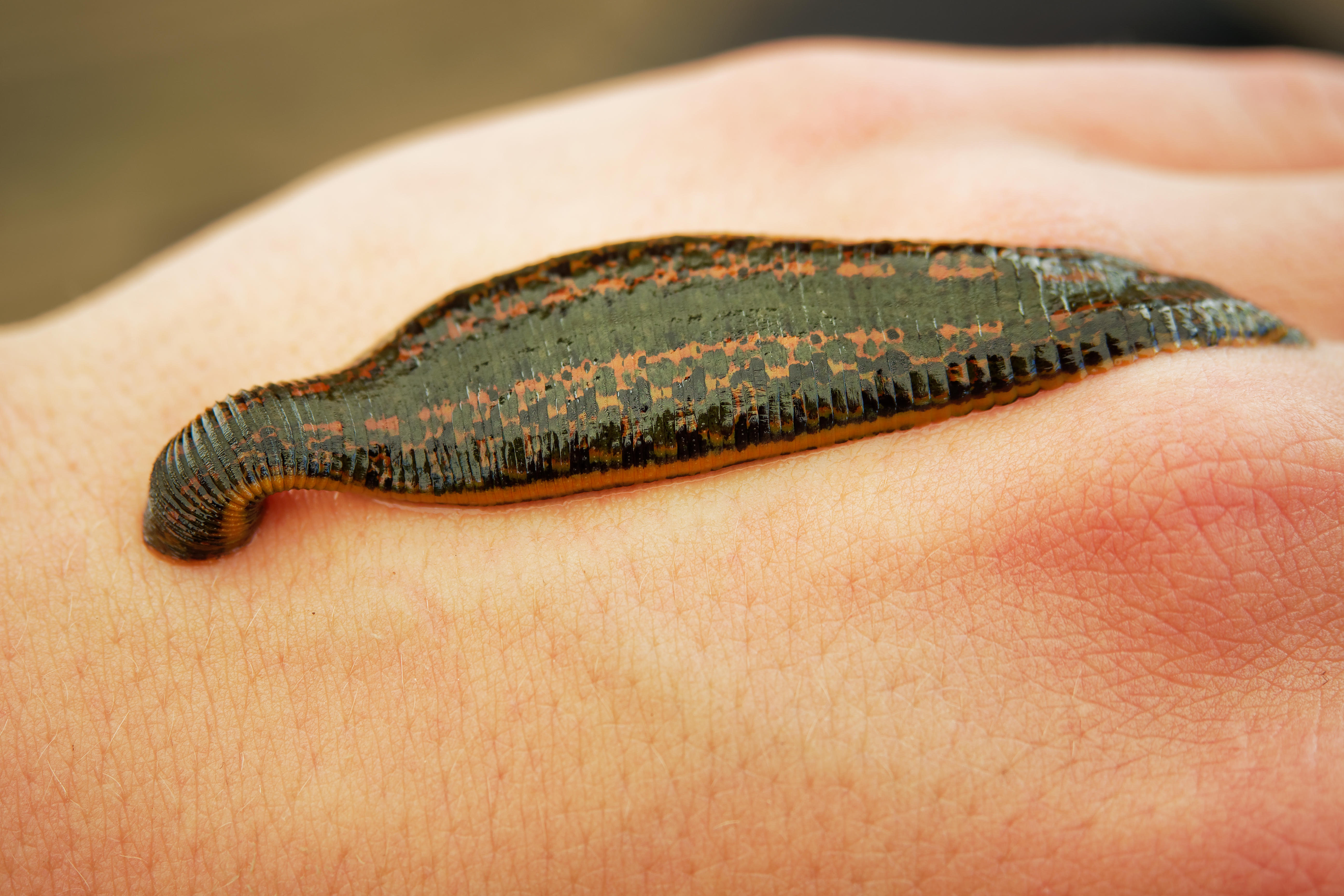 Hirudo medicinalis, the medicinal leech.