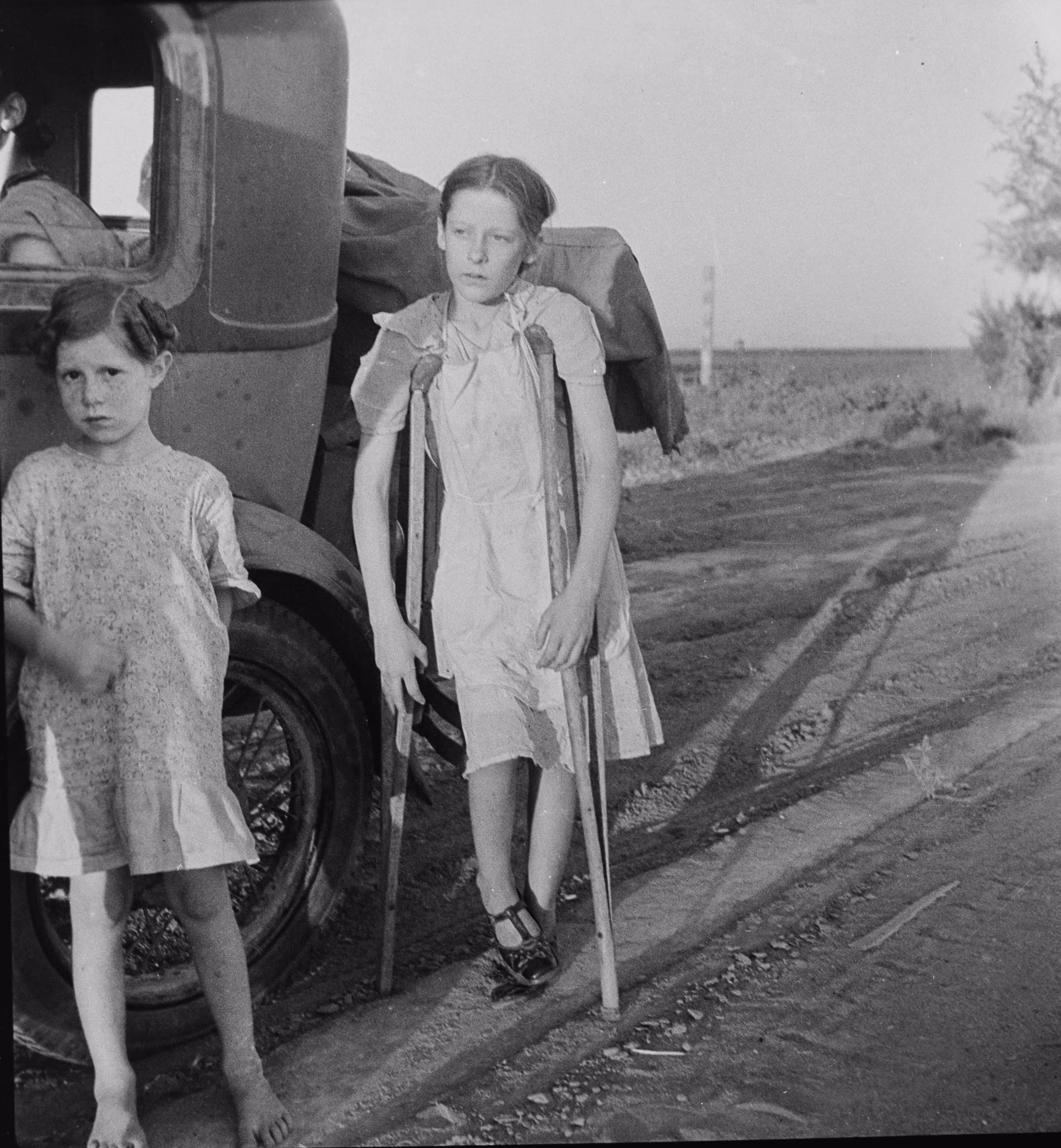 A young girl in Oklahoma suffering from bone tuberculosis.