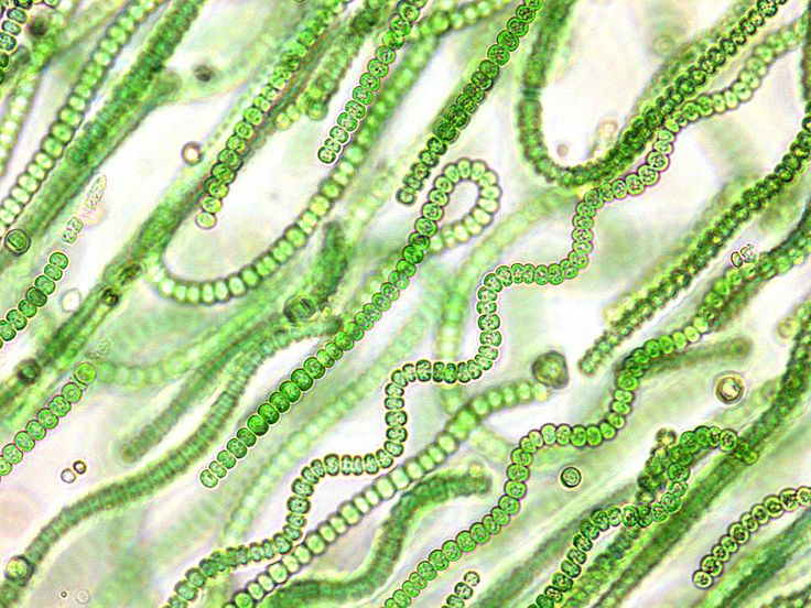 Cyanobacteria under the microscope.