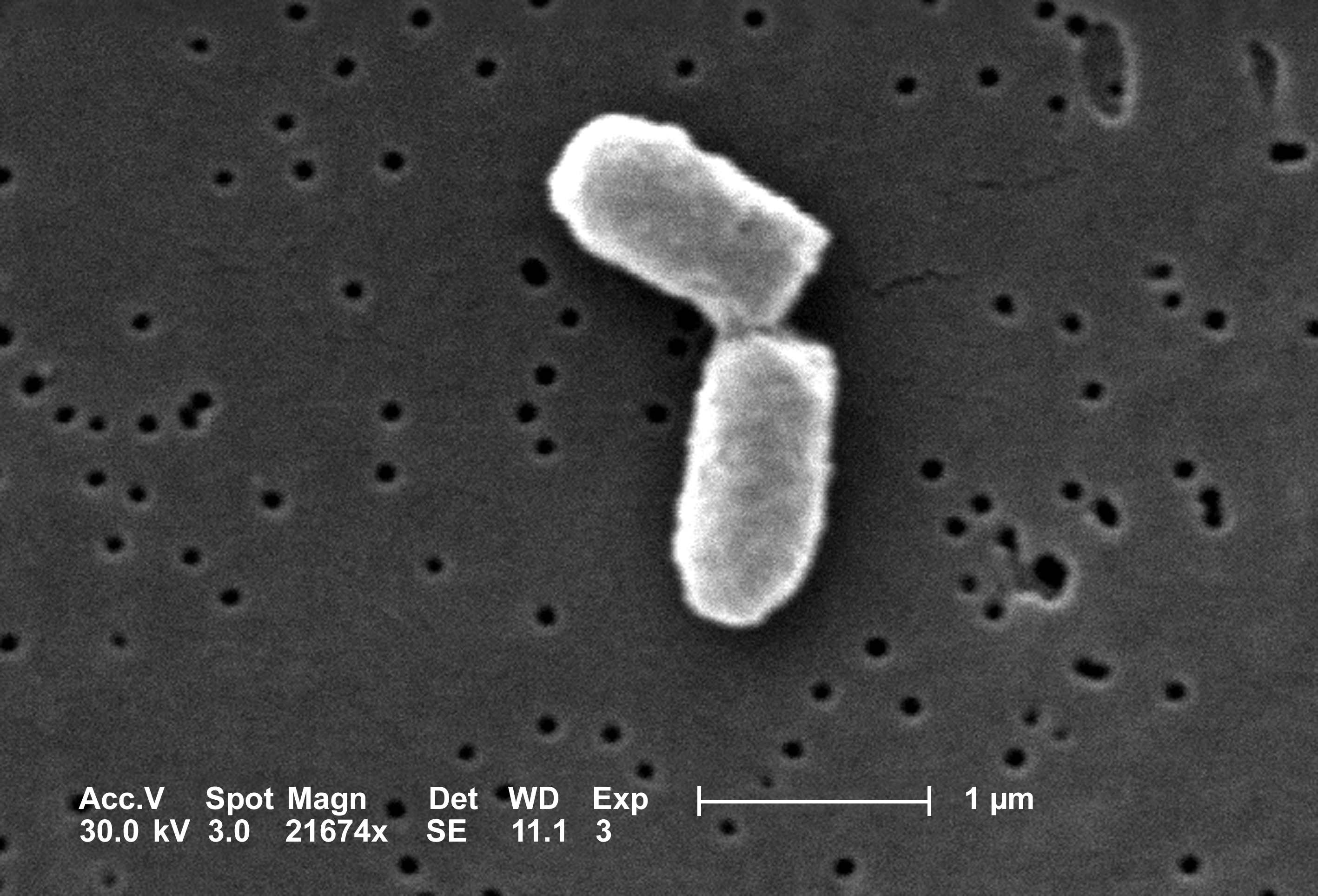 A scanning electron micrograph of a dividing E. coli cell.