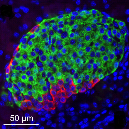 Fluorescence micrograph of beta cells in the Islet of Langerhans within the pancreas.