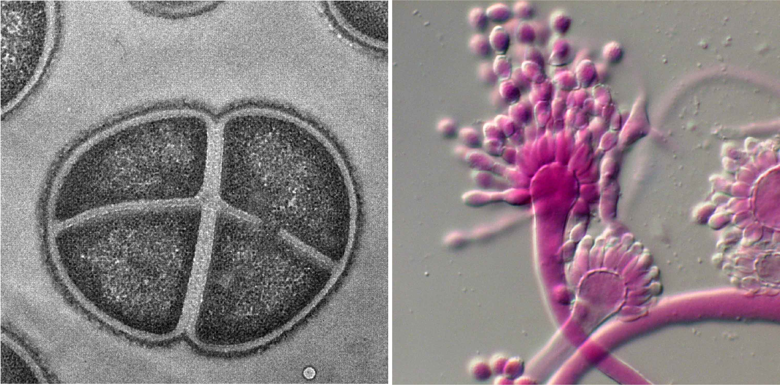 Deinococcus radiodurans and Aspergillus penicillioides, two extremophile microbes.
