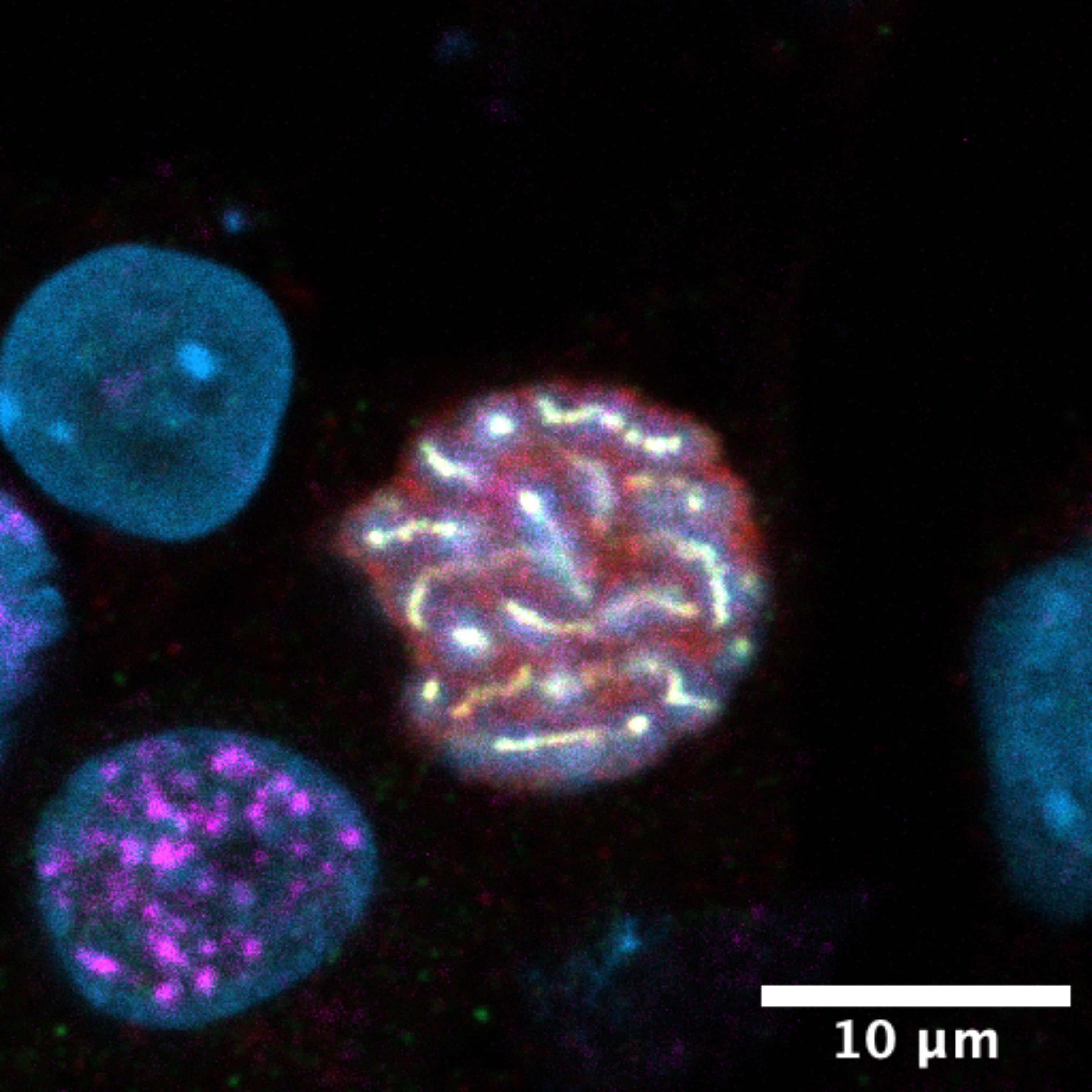 A meiotic cell nucleus viewed beneath the microscope.