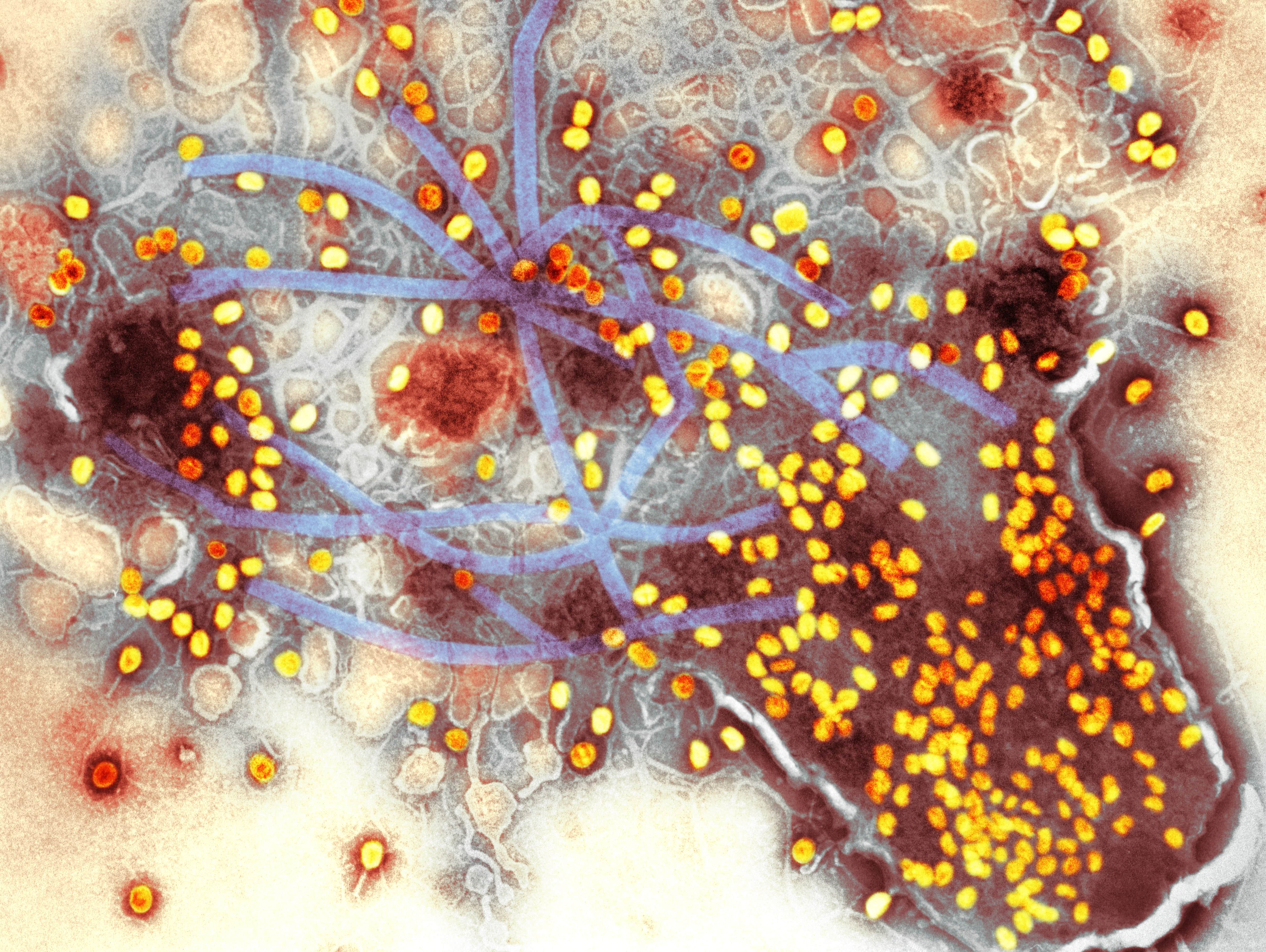 T4 bacteriophages lyse open a bacterial cell.