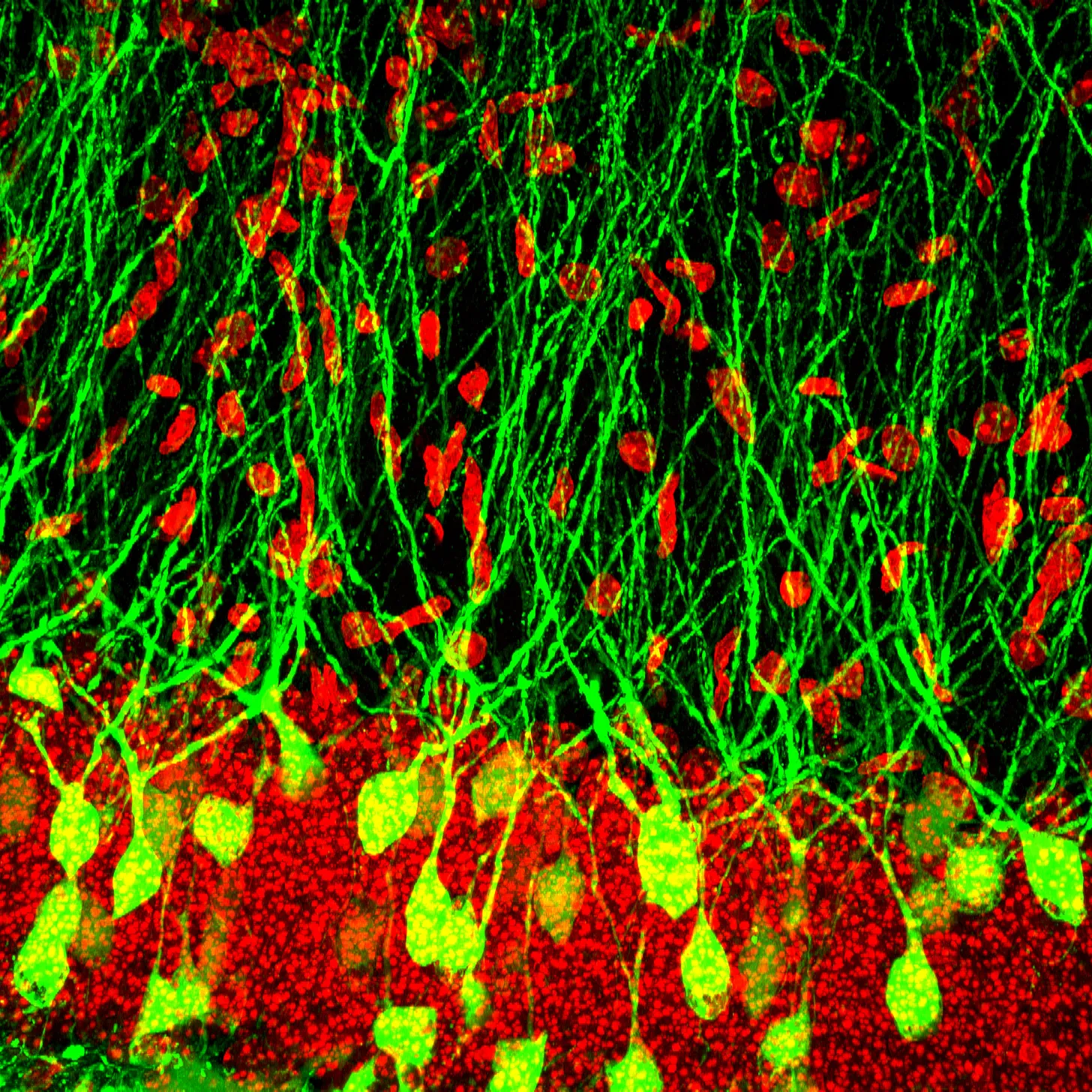 Sparse granule cells expressing GFP.