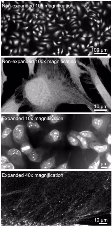 HeLa cells that have been expanded and imaged at various magnifications.