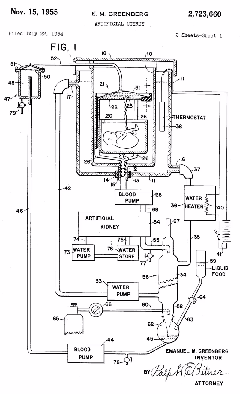 A schematic depicting an artificial womb, published in a 1954 patent application.