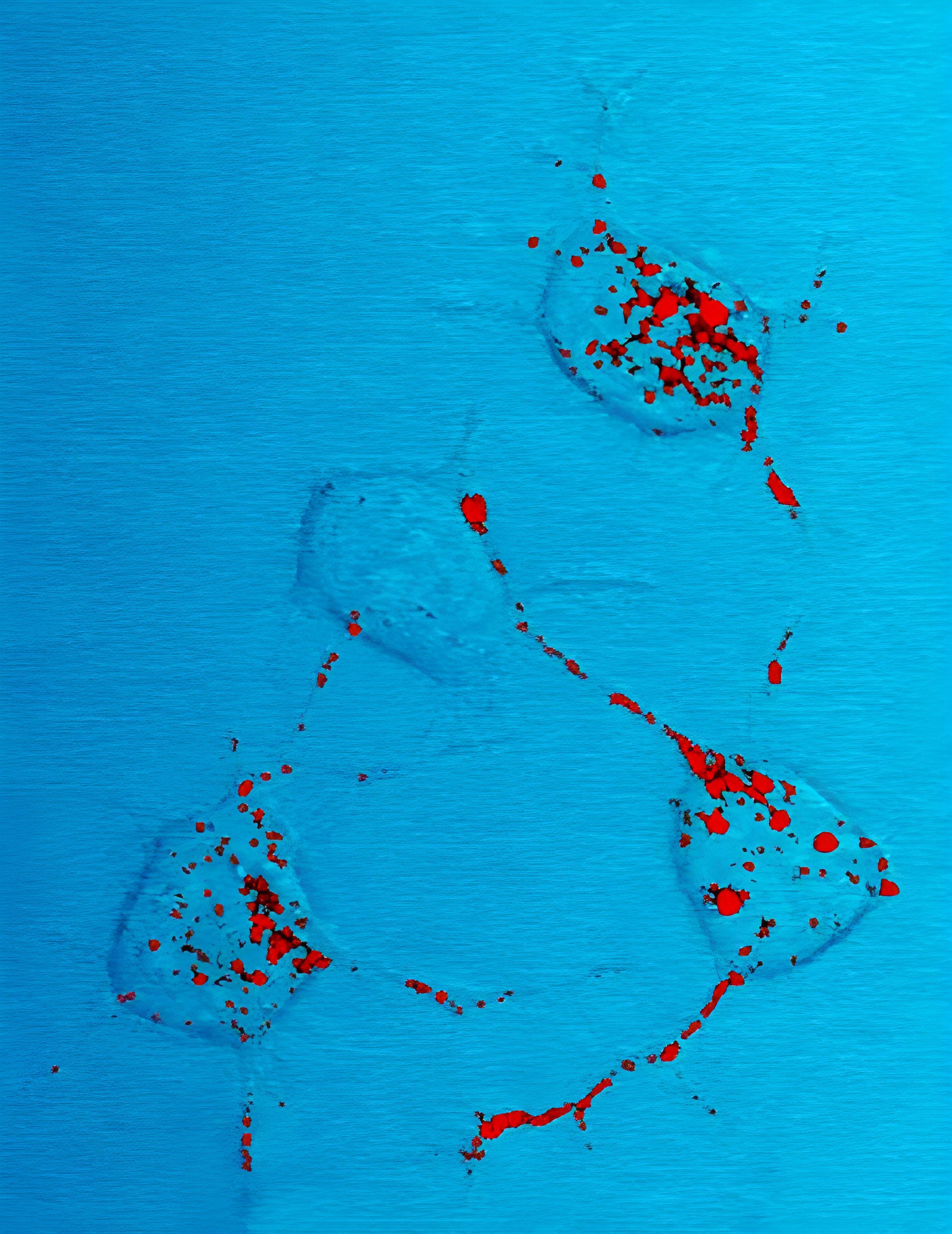 Fluorescence micrograph showing prion protein aggregates in red inside mouse nerve cells.