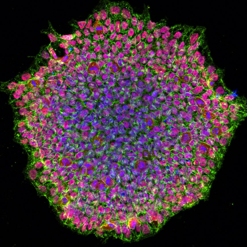 A colony of human induced pluripotent stem cells, with red, green, and blue fluorescent markers.