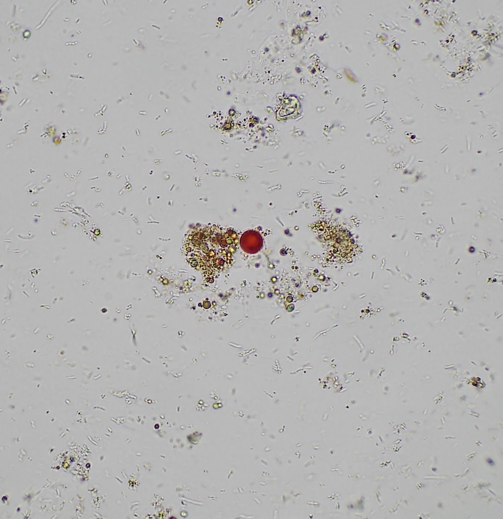 Kimchi under the microscope (400x magnification).