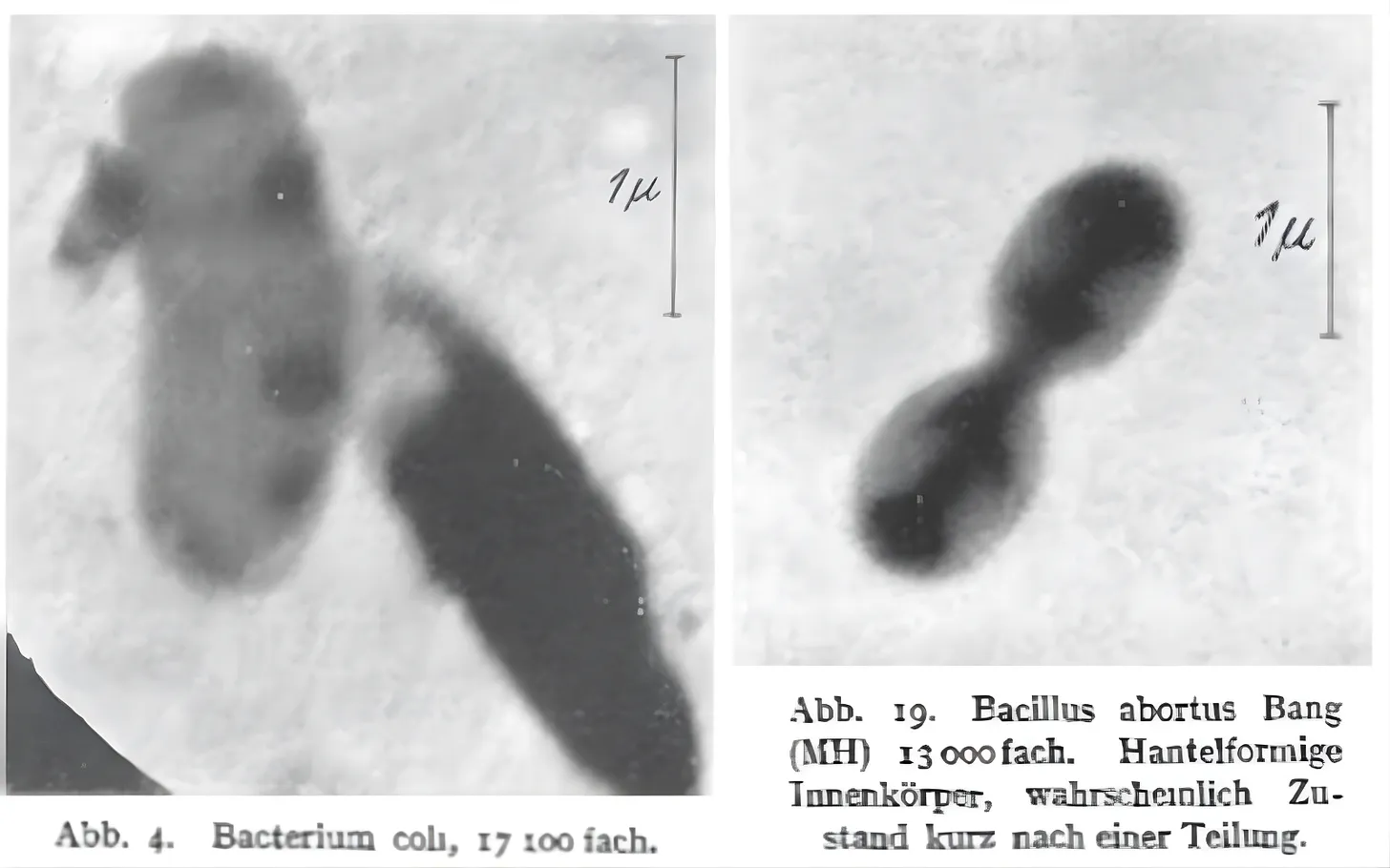 Electron micrographs of the mouse ectromelia virus