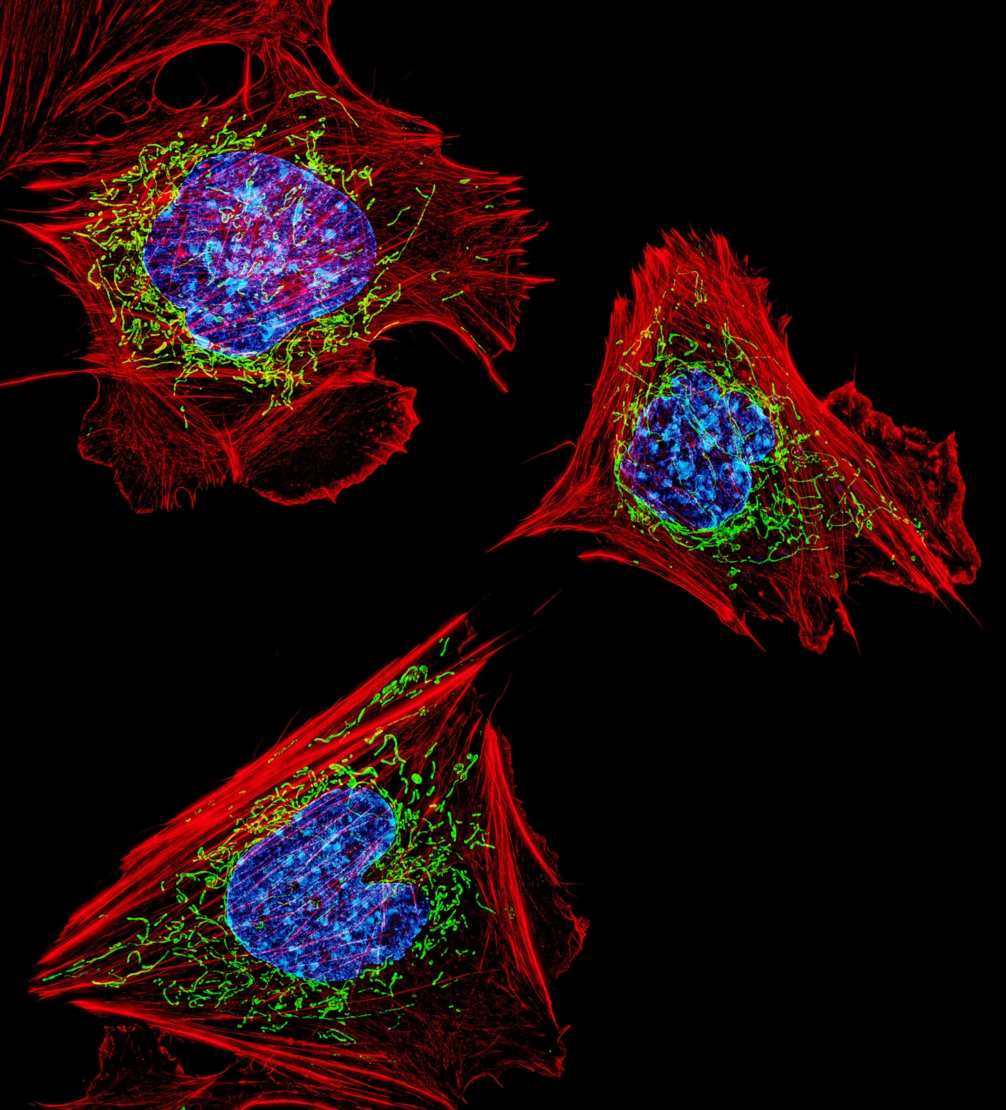 Cells with stained nuclei, mitochondria, and actin cytoskeleton