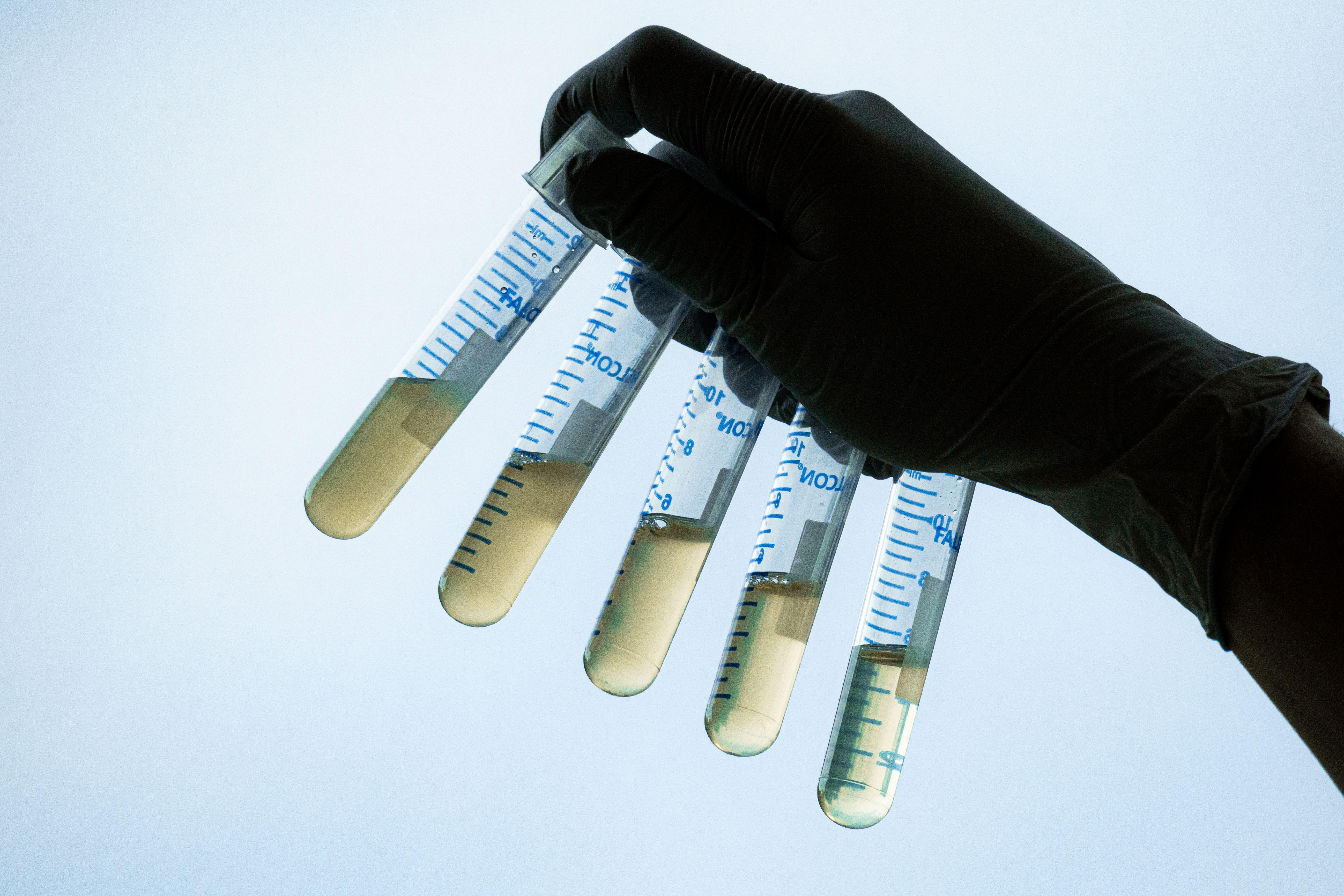 E. coli cultures at different densities.