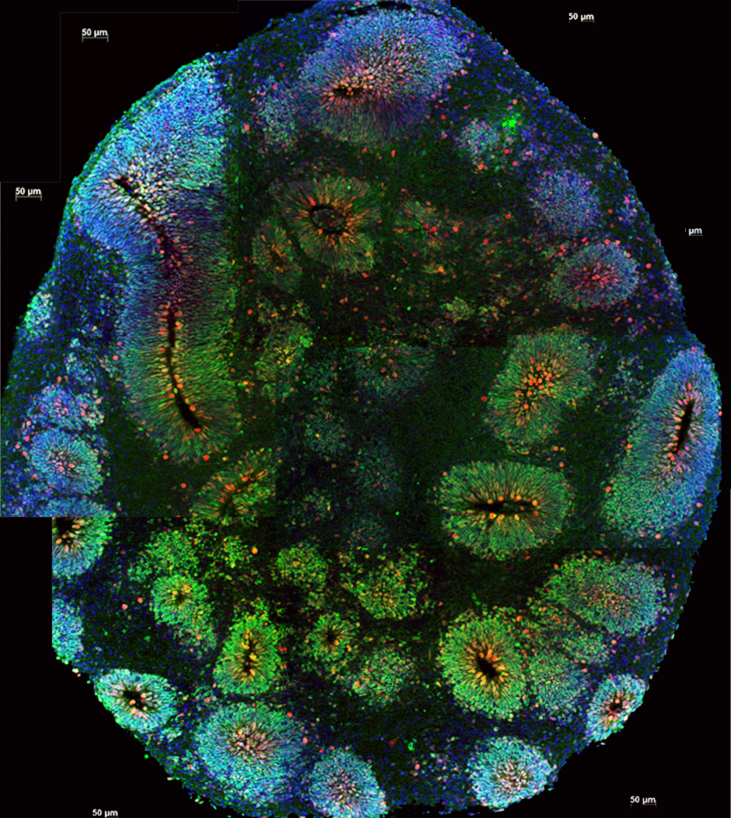 A brain organoid with lights indicating regions of gene expression