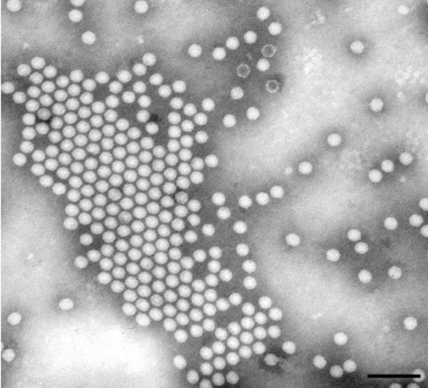 Negative stain of an icosahedral polyomavirus