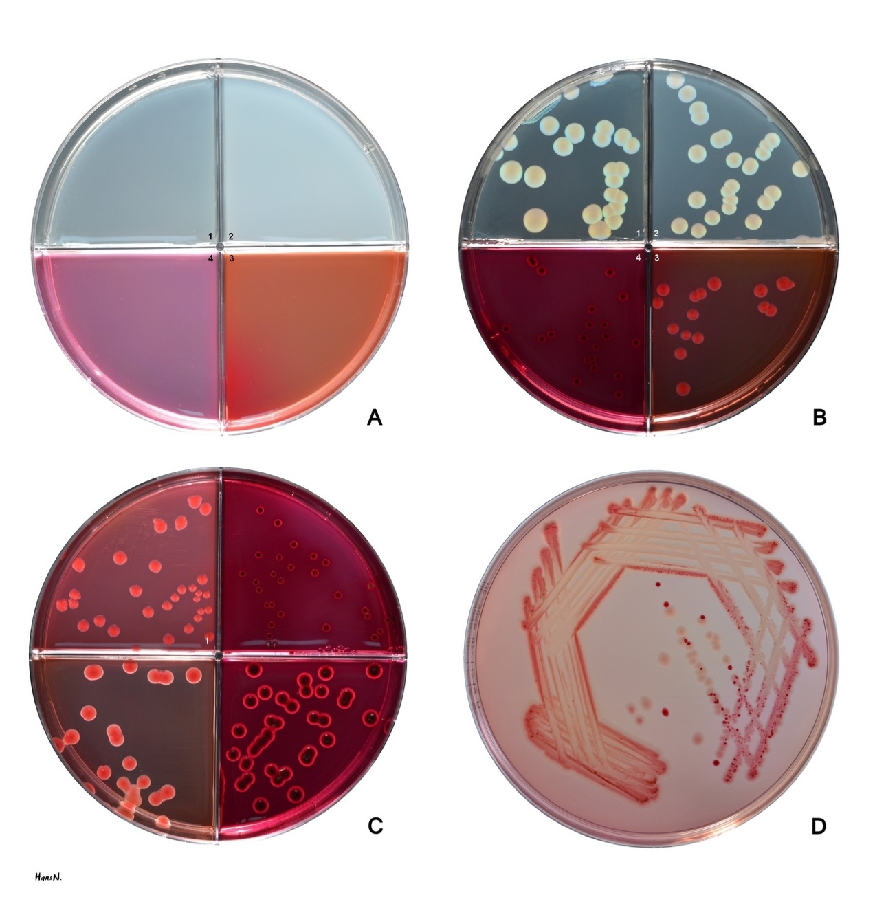Agar plates with E. coli growth on various concoctions