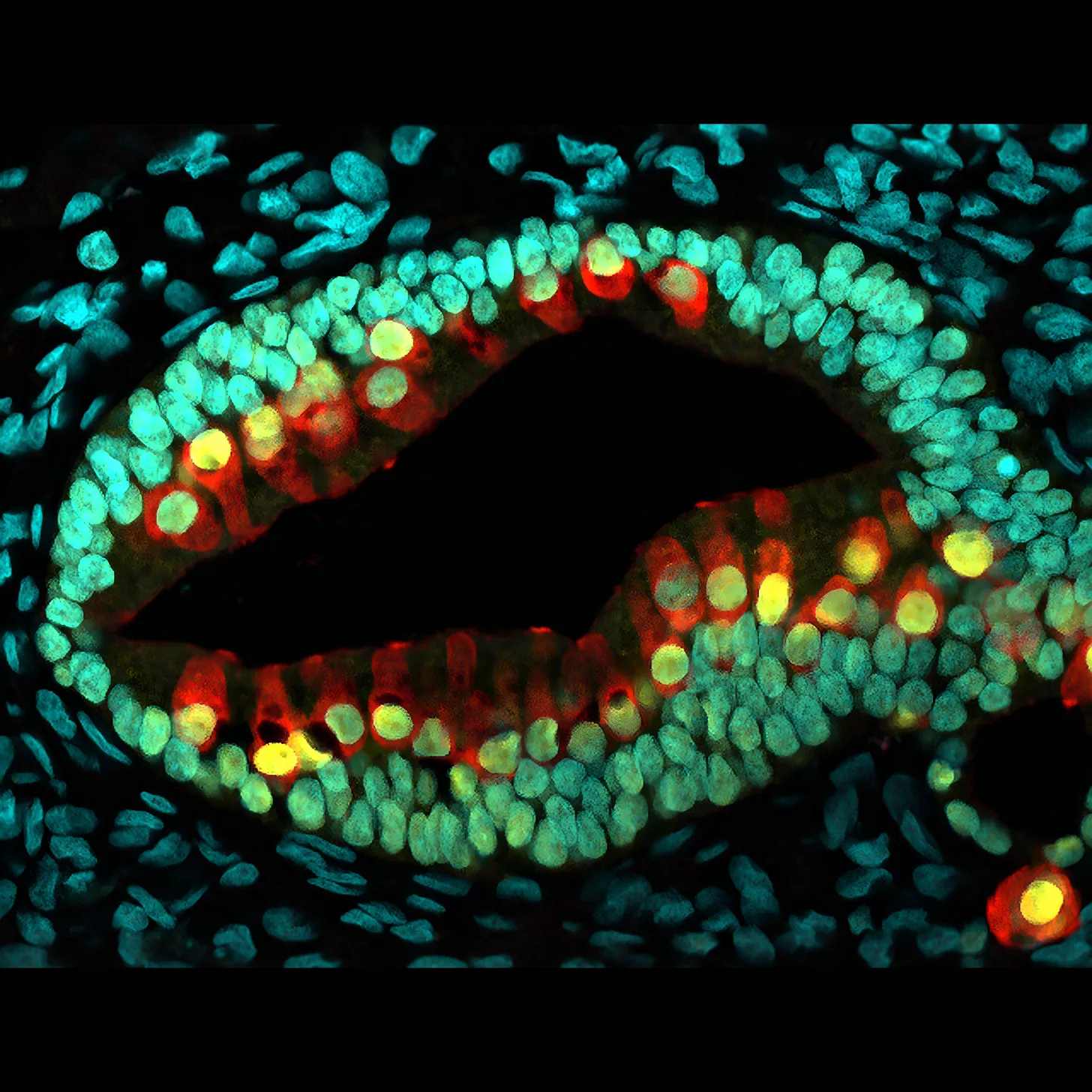 An ear organoid, with sound-responsive hair cells stained in red.