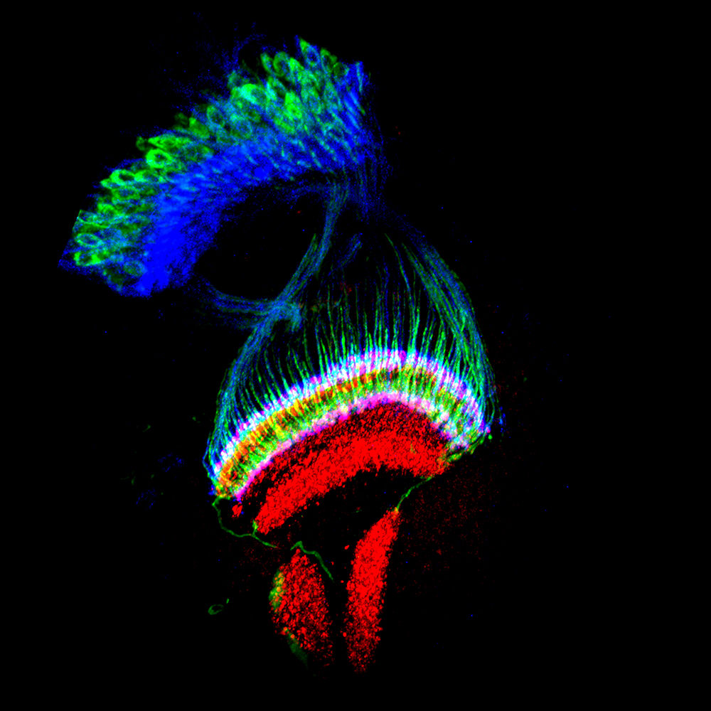 Thin section of the optic lobe from a pupal Drosophila brain