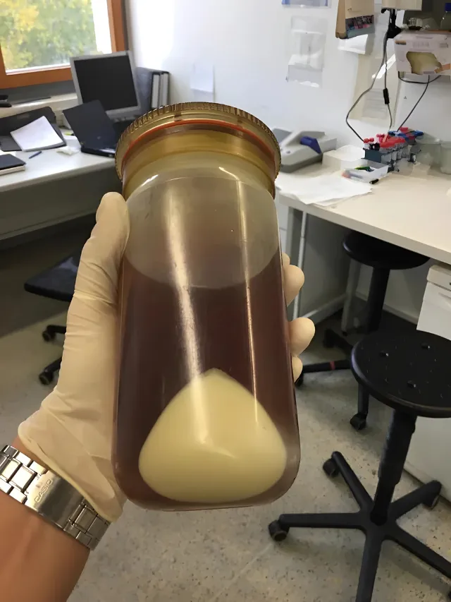 A pellet of E. coli cells in a 1-liter vessel.