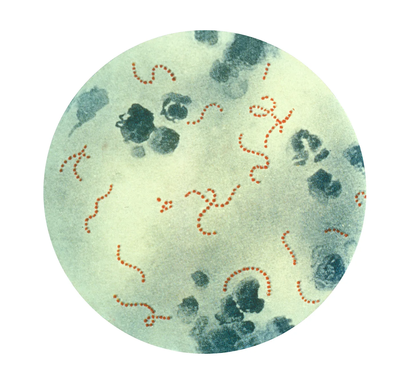 Illustration of S. pyogenes microbes at 900x magnification.