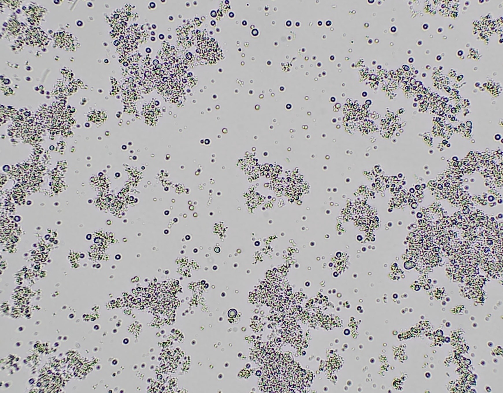 Kefir under the microscope (400x magnification).