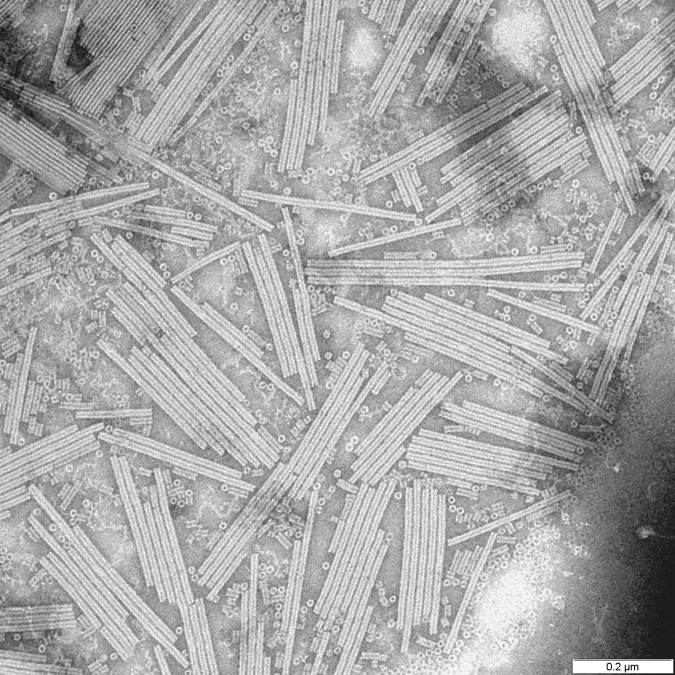 Electron micrograph of tobacco mosaic virus