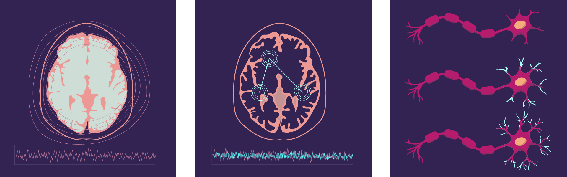 Neural activity data