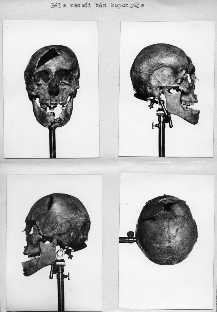 The original skull and jaw of Duke Béla of Macsó