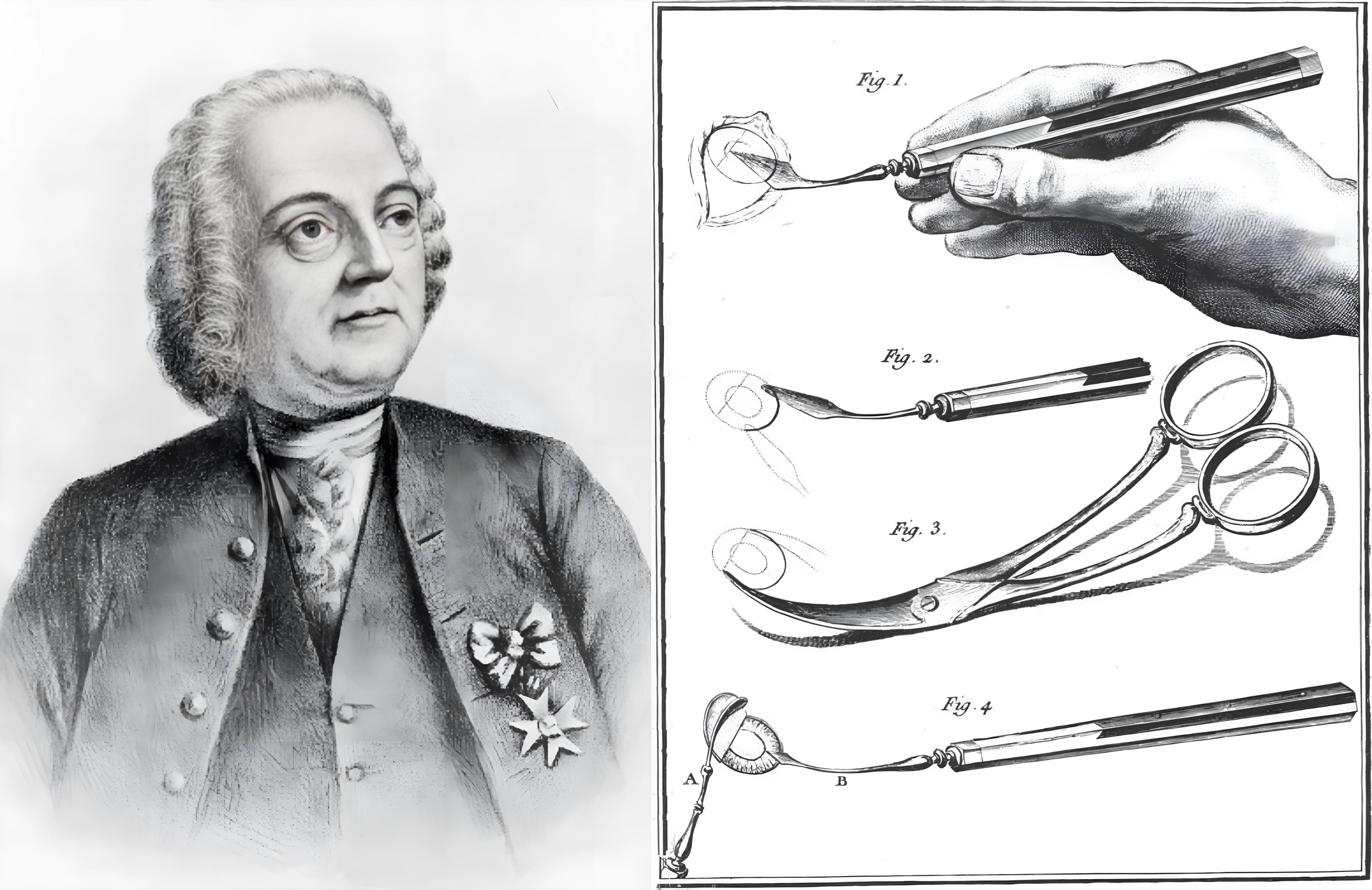 A portrait of Jacques Daviel alongside a depiction of his ECCE technique.