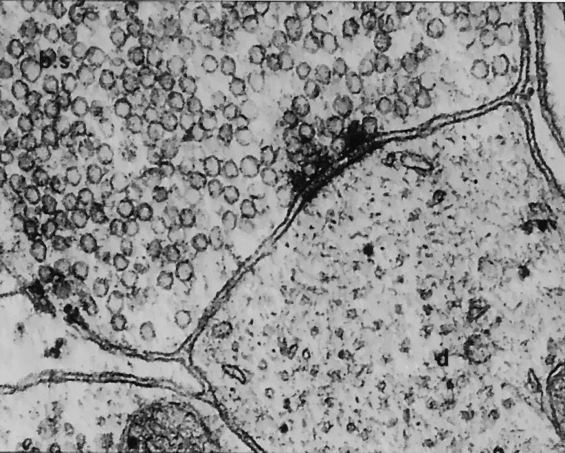 A neural synapse, imaged using an electron microscope.