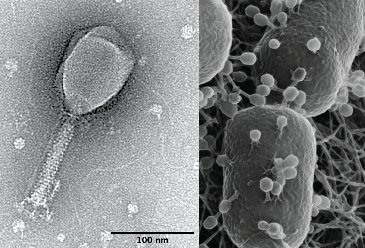 Scanning electron micrographs of bacteriophages: a T2 phage with scale bar, and T4 phages attached to living E. coli cells.