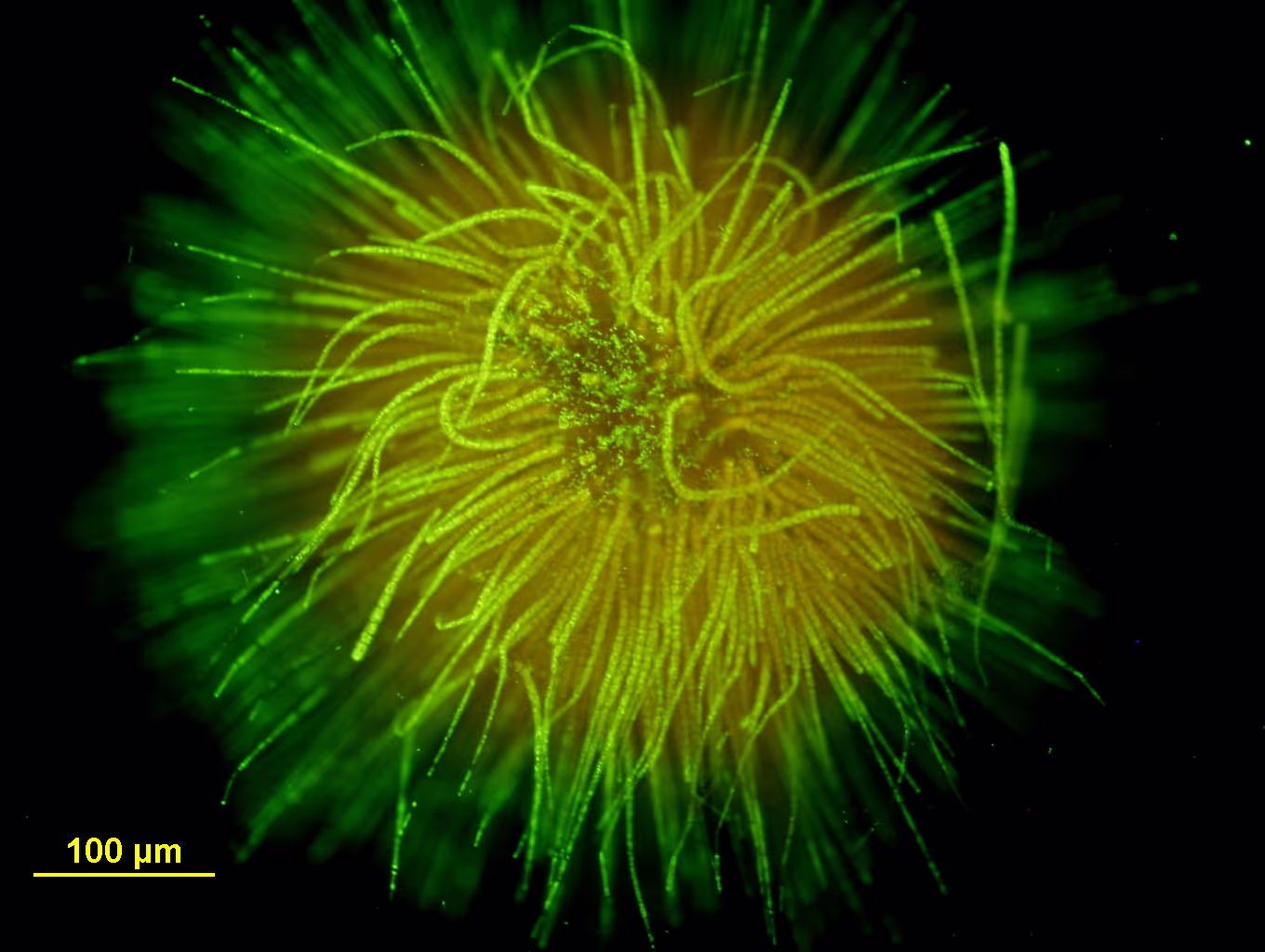 Gleotrichia echinulata cells with spindly tendrils radiating from a spherical core.