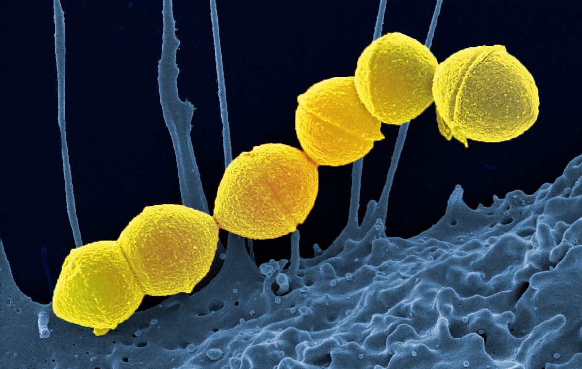 ಮಾಂಸ ತಿನ್ನುವ ವೈರಸ್ - Flesh Eating Bacteria Cases in Japan