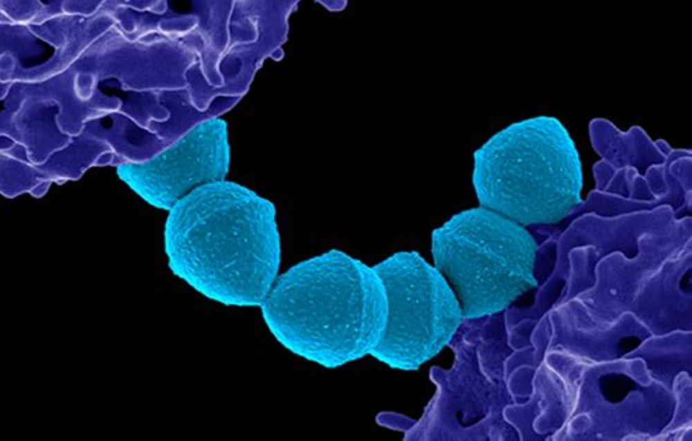 ಮಾಂಸ ತಿನ್ನುವ ವೈರಸ್ Flesh Eating Bacteria
