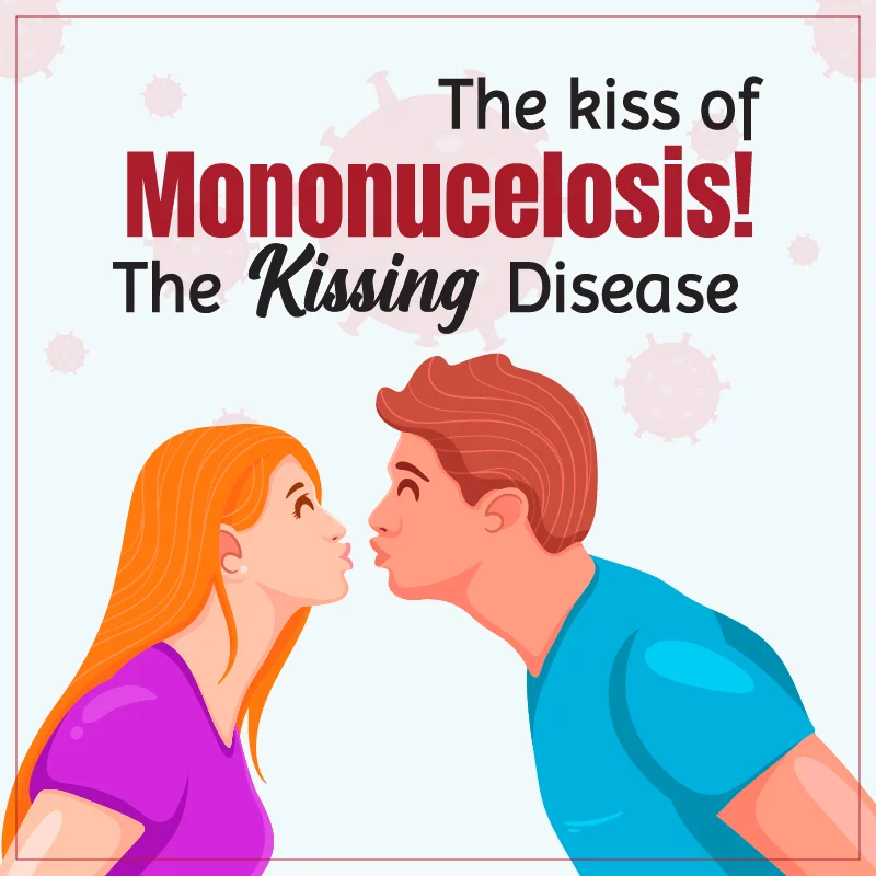 Kissing ಕಾಯಿಲೆಯಿಂದ ಆಸ್ಪತ್ರೆಗೆ ದಾಖಲಾಗಿರುವ ವಿದ್ಯಾರ್ಥಿ! ಏನಿದು ಹೊಸ ಕಾಯಿಲೆ, ಲಕ್ಷಣಗಳೇನು? What Is Kissing Disease mononucleosis symptoms of the kissing disease kannada newsten digital