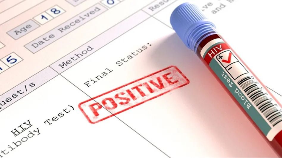 Students HIV Case: ಶಾಕಿಂಗ್ ನ್ಯೂಸ್! ಒಂದೇ ರಾಜ್ಯದಲ್ಲಿ 828 ಕಾಲೇಜು ವಿದ್ಯಾರ್ಥಿಗಳಿಗೆ (HIV) ಎಚ್ಐವಿ ಪಾಸಿಟಿವ್! 47 ಮಂದಿ ಏಡ್ಸ್ನಿಂದ ಸಾವು! Students HIV Case: ಶಾಕಿಂಗ್ ನ್ಯೂಸ್! ಒಂದೇ ರಾಜ್ಯದಲ್ಲಿ 828 ಕಾಲೇಜು ವಿದ್ಯಾರ್ಥಿಗಳಿಗೆ (HIV) ಎಚ್ಐವಿ ಪಾಸಿಟಿವ್! 47 ಮಂದಿ ಏಡ್ಸ್ನಿಂದ ಸಾವು!