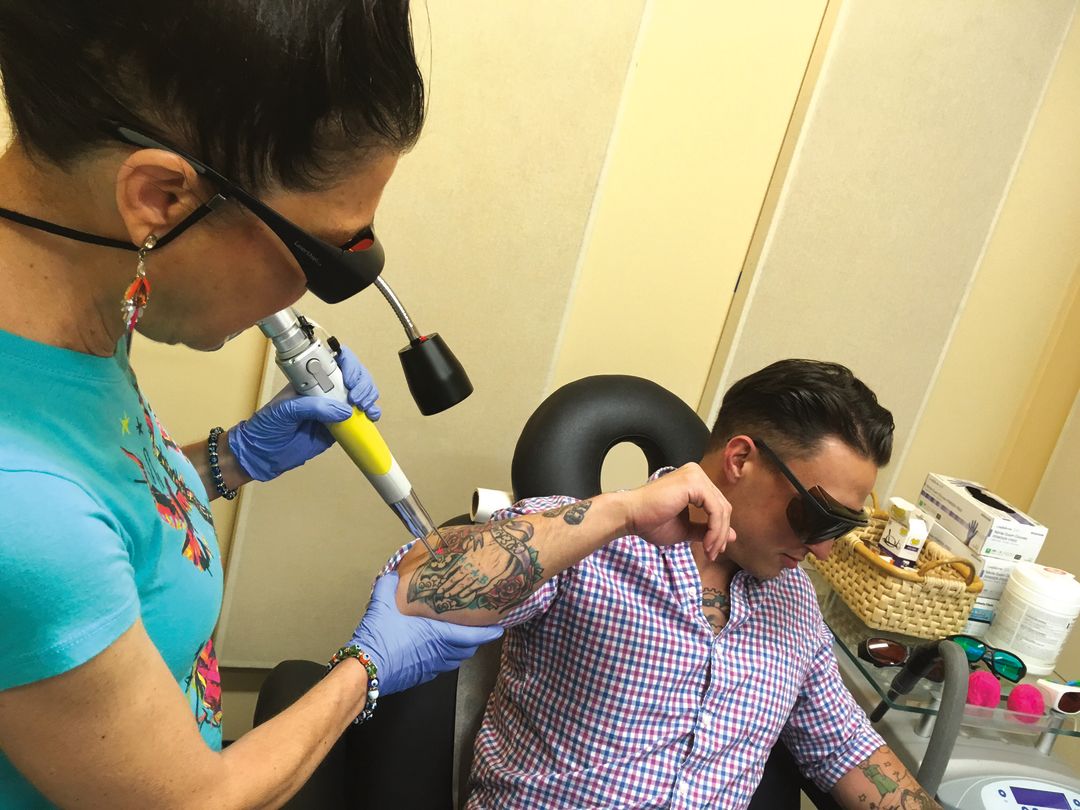 Laser Tattoo Removal Portland  Oregon Tattoo Removal Clinic  Tigard OR