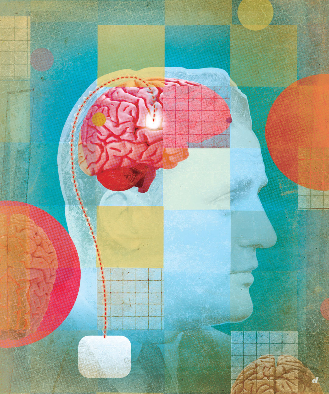 0517 icehouse depression brain illustration itdgc6