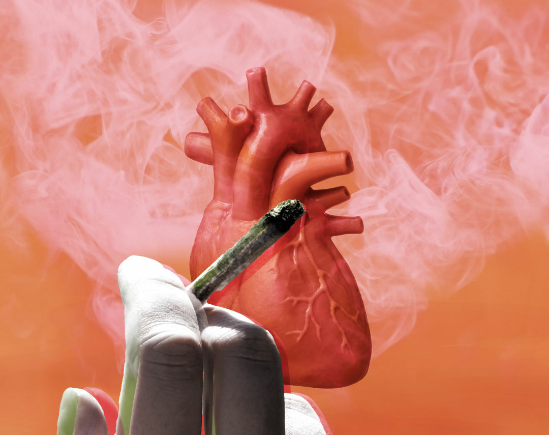 Marijuana Use Tied to Heart Failure