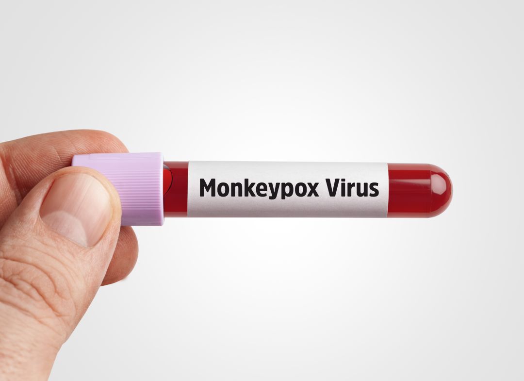 Monkeypox virus