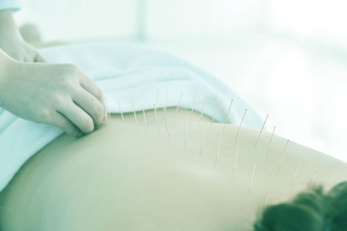The Portland Area’s Top Acupuncturists, as Chosen by Their Peers
