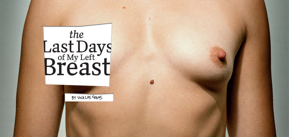 I had a double mastectomy and love flaunting my flat chest