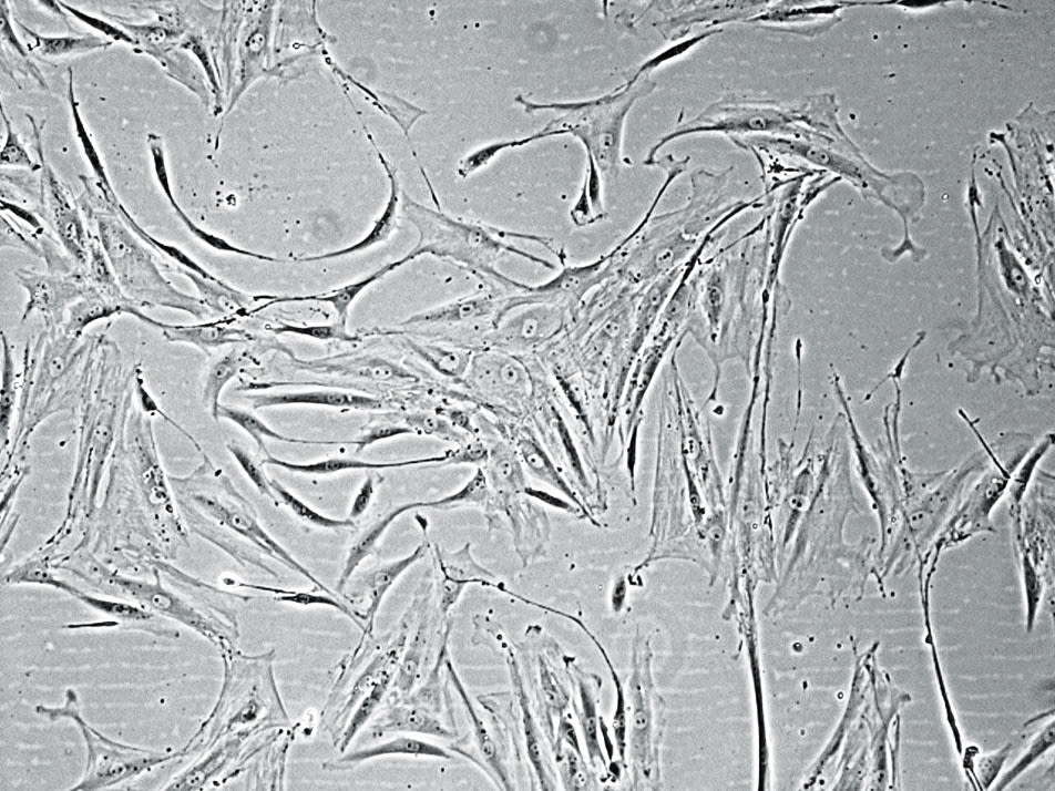 0804 pg107 cell harvest jeangx