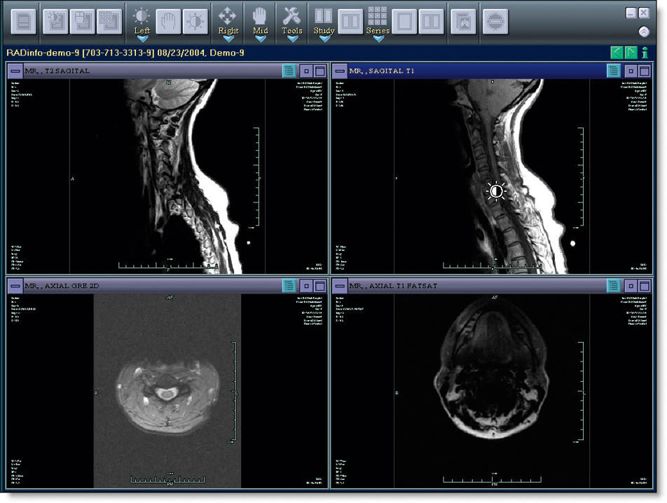 03 060 breast scan z0mbwv