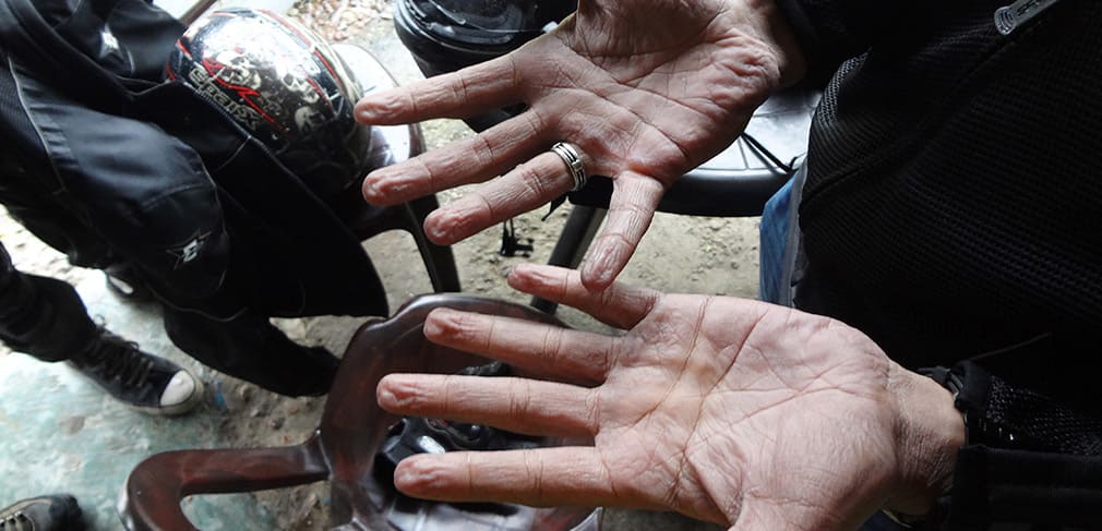 Bala_Hands_After_Rains_in_Gloves