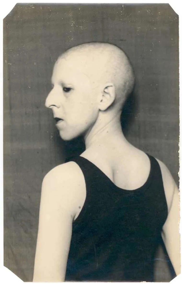 Person with a shaved head and distinctive facial features wears a sleeveless top, looking over their shoulder. Black and white photo.