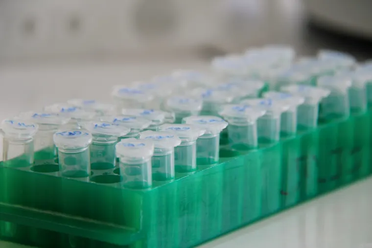 Rows of clear plastic test tubes with white caps on a green holder in a laboratory setting.